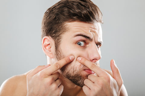 Decoding Acne: A Comprehensive Guide to Different Types for Men